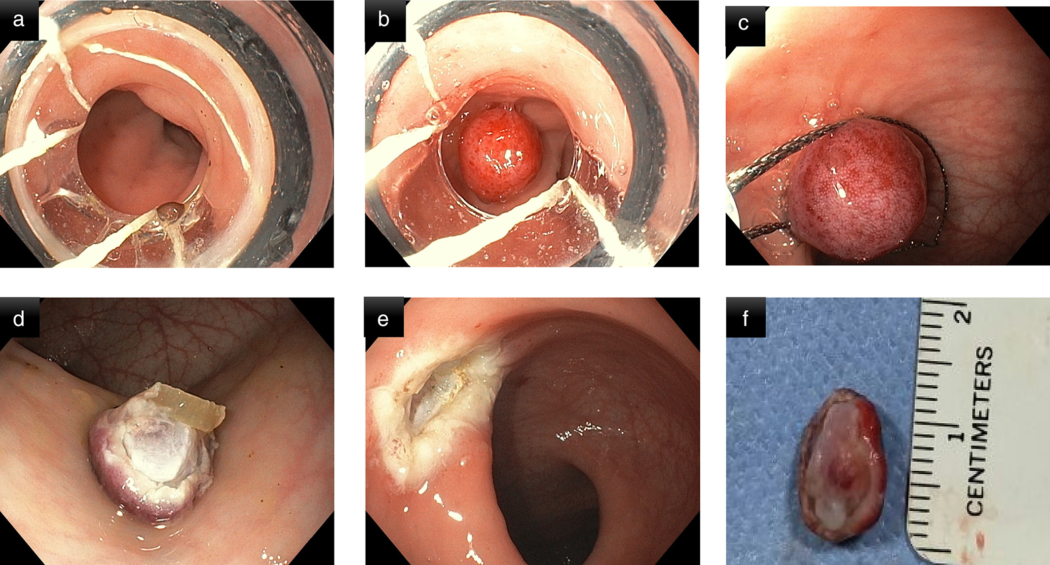 Endoscopy3