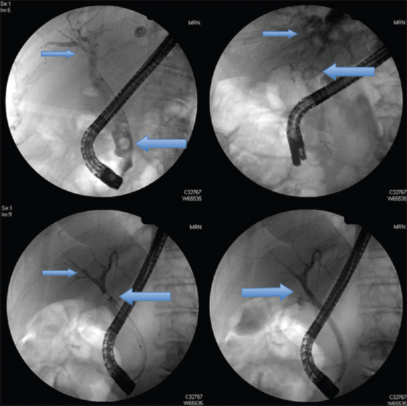 Endoscopy2